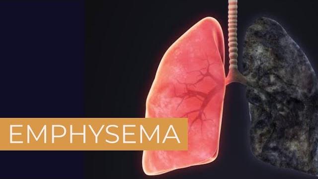 Emphysema | the white army Emphysema | the white army