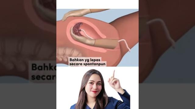 Perjuangan seorang ibu hamil - medikacare Perjuangan seorang ibu hamil - medikacare