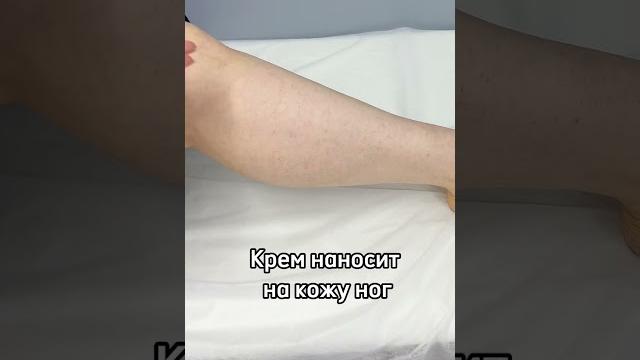 Мазь от варикоза. флеболог москва. Мазь от варикоза. флеболог москва.
