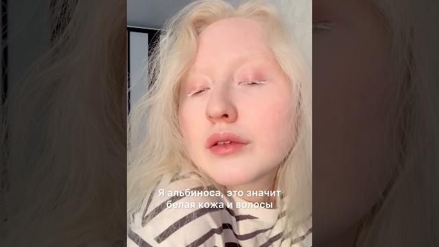 У альбиносов красные глаза? #альбинизм #альбинос У альбиносов красные глаза? #альбинизм #альбинос