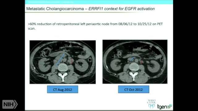 Comprehensive molecular profiling to support treatment recommendations for advanced cancer Comprehensive molecular profiling to support treatment recommendations for advanced cancer