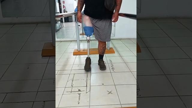 Transfemoral #amputee gait #shorts #prosthesis #bilateralamputee #rehab #gait #amputeelife Transfemoral #amputee gait #shorts #prosthesis #bilateralamputee #rehab #gait #amputeelife