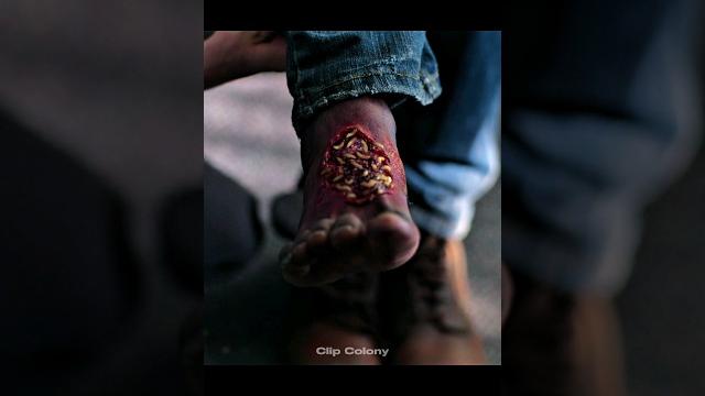 His foot was infected by worms 🪱 #movie #series His foot was infected by worms 🪱 #movie #series