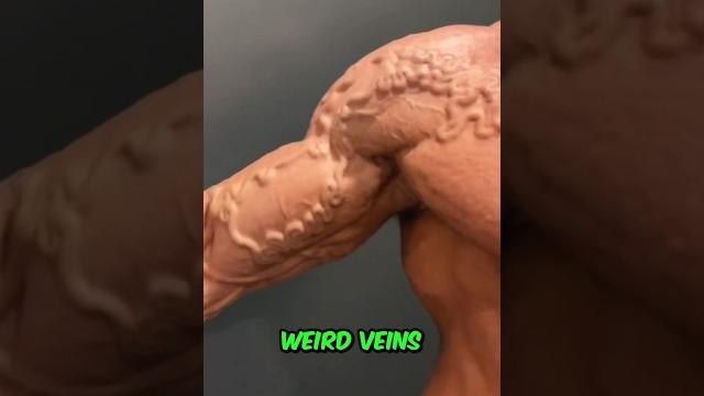 Why veins look like this Why veins look like this