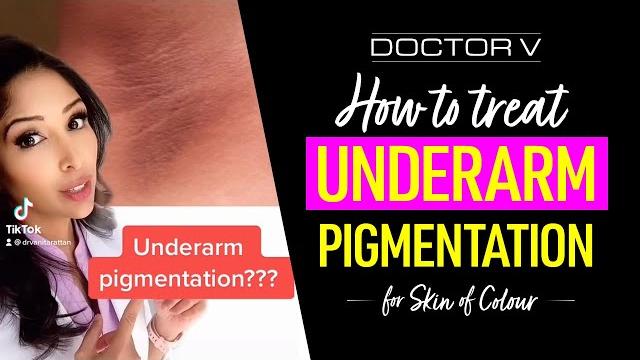 Doctor v - how to treat underarm pigmentation for skin of colour | brown or black skin | #shorts Doctor v - how to treat underarm pigmentation for skin of colour | brown or black skin | #shorts