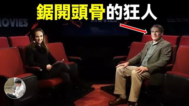 切開自己的頭骨,祖孫三代換血,科學怪人門都有哪些離譜操作,真的有理論依據嗎? 切開自己的頭骨,祖孫三代換血,科學怪人門都有哪些離譜操作,真的有理論依據嗎?