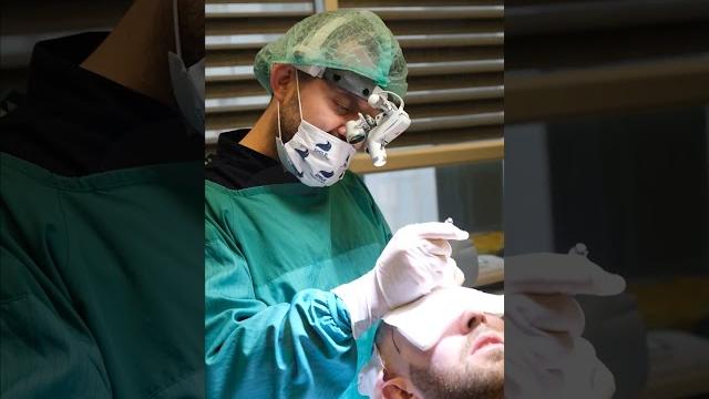Hair transplant day of a patient Hair transplant day of a patient