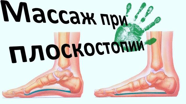 Массаж при плоскостопии у ребёнка Массаж при плоскостопии у ребёнка