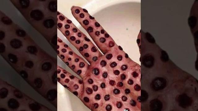 Do they scare you? #trypophobia #phobia Do they scare you? #trypophobia #phobia