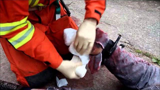 Blast bandage simulation Blast bandage simulation