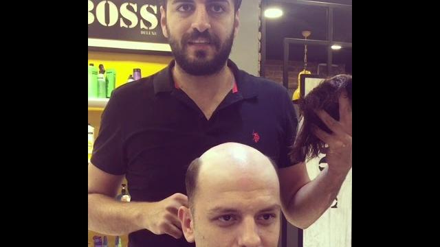 Protez saç bursa Protez saç bursa