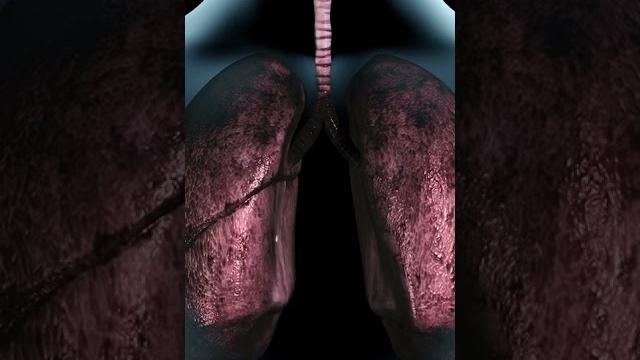 How exactly does smoking affect the body How exactly does smoking affect the body