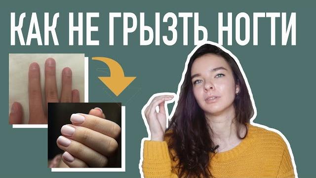 Как избавиться? я грызла ногти 20 лет Как избавиться? я грызла ногти 20 лет