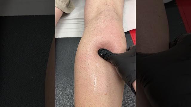 Deep tissue massage calf pain Deep tissue massage calf pain