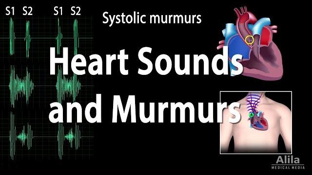 Heart sounds and heart murmurs, animation. Heart sounds and heart murmurs, animation.