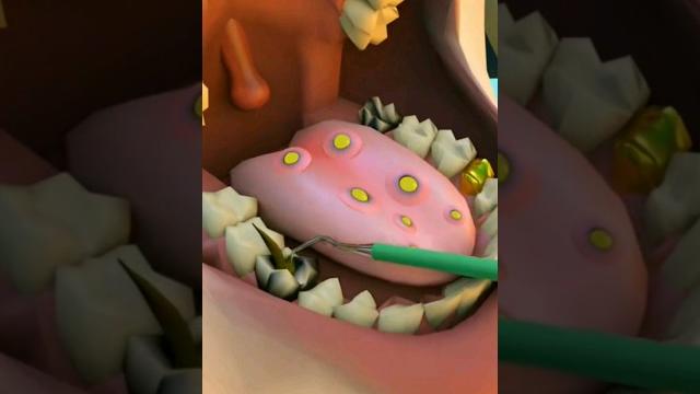 Dental problem #asmr #asmrvideo #asmrsounds #animation #dental #dentist #doctor #shorts #tretment Dental problem #asmr #asmrvideo #asmrsounds #animation #dental #dentist #doctor #shorts #tretment