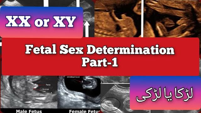 Fetal sex determination | xx or xy ️ boy or girl #medical #pregnancy #ultrasound #gender Fetal sex determination | xx or xy ️ boy or girl #medical #pregnancy #ultrasound #gender