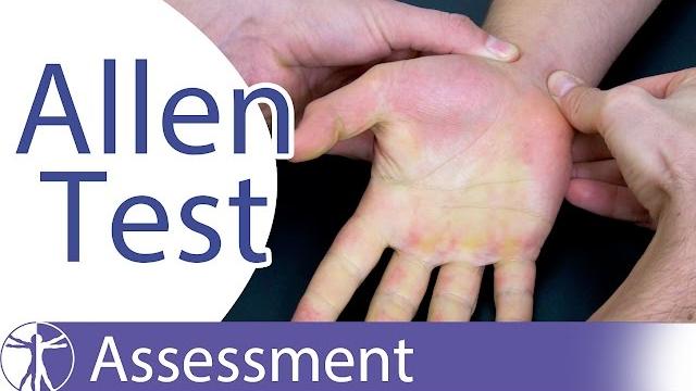 Allen test⎟hand vascularisation Allen test⎟hand vascularisation