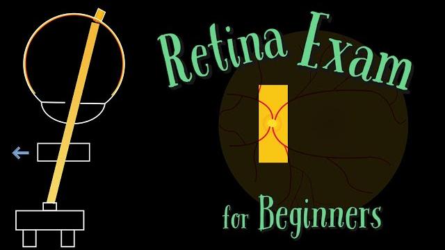 Retina exam on slit lamp - complete guide Retina exam on slit lamp - complete guide