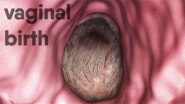 Vaginal-birth, natural -childbirth Vaginal-birth, natural -childbirth