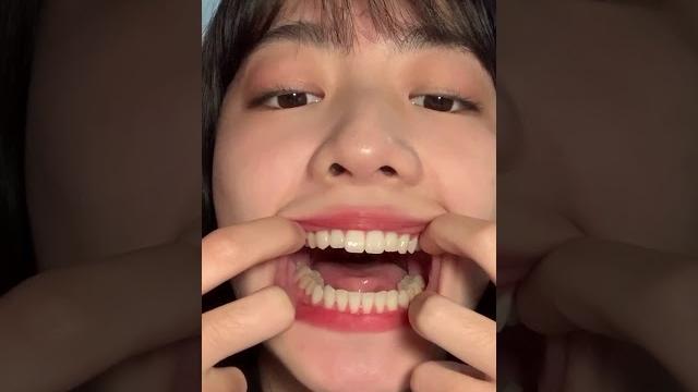 美女口腔视频 美女口腔视频