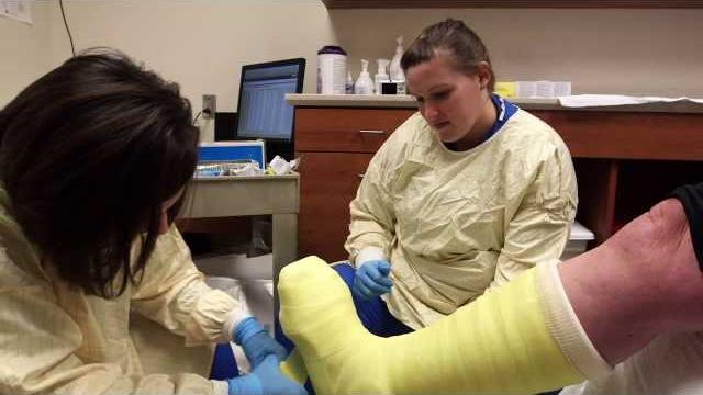 Total contact cast for diabetic foot ulcers | iu health Total contact cast for diabetic foot ulcers | iu health