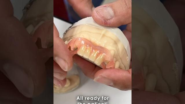 Making a @tcsdentalinc fiberflex partial #tcsdentalinc #dental #lsk121shorts #teeth #shortvideo Making a @tcsdentalinc fiberflex partial #tcsdentalinc #dental #lsk121shorts #teeth #shortvideo