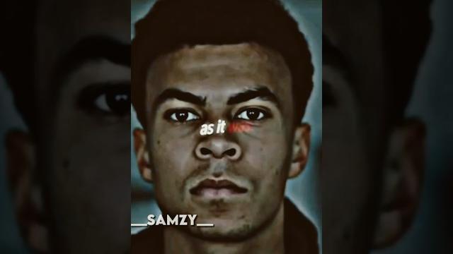 I miss dele alli I miss dele alli