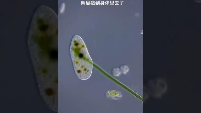 挠痒痒 挠痒痒