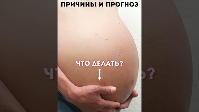 Чем опасен асцит? что делать при водянке брюшной полости? #меднавигатор #асцит #водянка Чем опасен асцит? что делать при водянке брюшной полости? #меднавигатор #асцит #водянка
