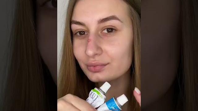 Как убрать подкожные прыщи? 2 бюджетных средства Как убрать подкожные прыщи? 2 бюджетных средства