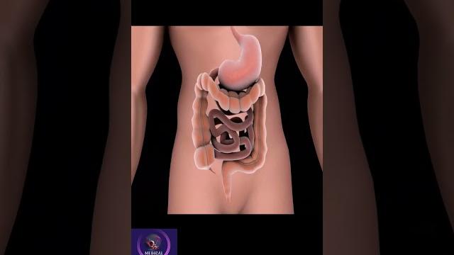 Diarrhea condition #shorts Diarrhea condition #shorts
