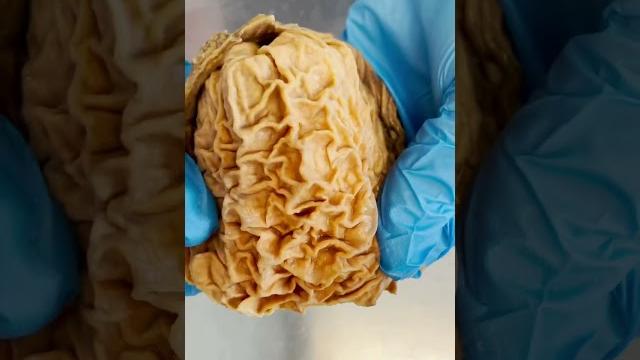 Looking inside a real human stomach | #shorts #food Looking inside a real human stomach | #shorts #food