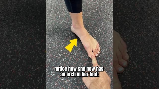 How to fix flat feet naturally! How to fix flat feet naturally!