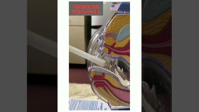 How to insert vaginal cream.. very effective treatment of vaginitis or any fungal infection. How to insert vaginal cream.. very effective treatment of vaginitis or any fungal infection.