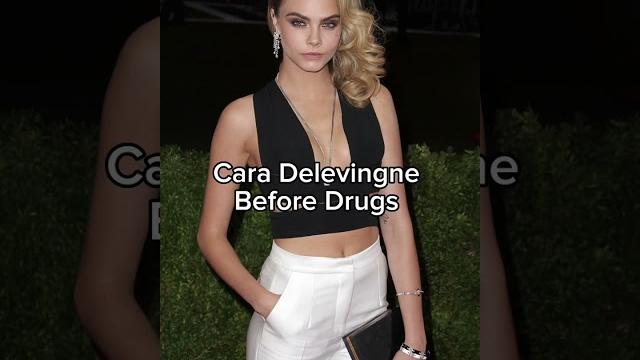 Cara delevingne before and after drugs ️🩹 #modelingagency #drugaddiction #caradelevingne Cara delevingne before and after drugs ️🩹 #modelingagency #drugaddiction #caradelevingne