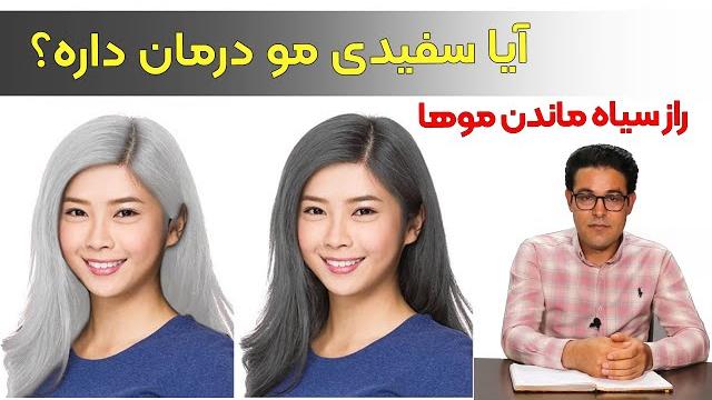 سفیدی مو | درمان سفیدی مو | سفیدی مو را چگونه از بین ببریم | درمان سفیدی مو دکتر خیراندیش سفیدی مو | درمان سفیدی مو | سفیدی مو را چگونه از بین ببریم | درمان سفیدی مو دکتر خیراندیش