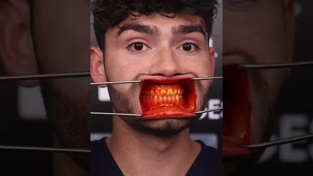Orange asmr snacks vs cavities!? Orange asmr snacks vs cavities!?