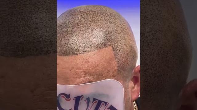 Mr cutz smp | scalp micropigmentation Mr cutz smp | scalp micropigmentation