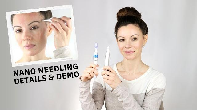 Nano needling vs microneedling | demo & details Nano needling vs microneedling | demo & details