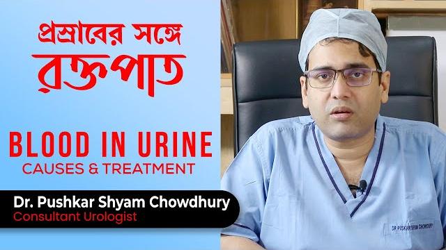 প্রস্রাবের সঙ্গে রক্তপাত হওয়ার কারণ কি | blood in urine or haematuria causes & treatment প্রস্রাবের সঙ্গে রক্তপাত হওয়ার কারণ কি | blood in urine or haematuria causes & treatment