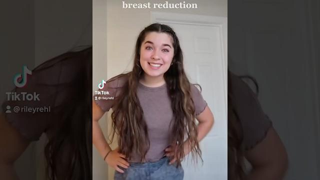 Breast reduction before & after! feeling grateful 🫶 Breast reduction before & after! feeling grateful 🫶
