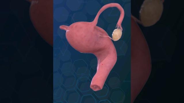 Uterus and ovaries | female reproductive system ️️ Uterus and ovaries | female reproductive system ️️