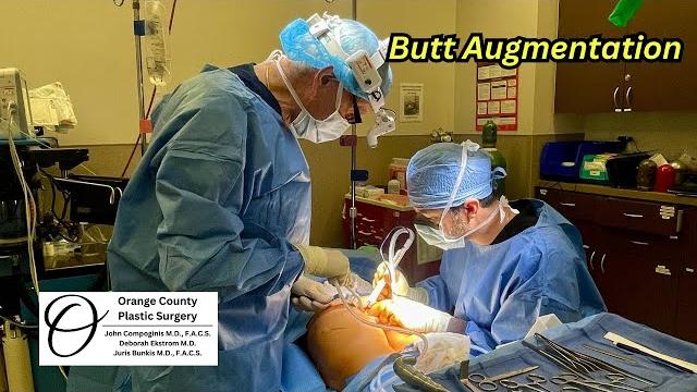 Butt augmentation | orange county plastic surgery #plasticsurgeon #plasticsurgeryresults Butt augmentation | orange county plastic surgery #plasticsurgeon #plasticsurgeryresults