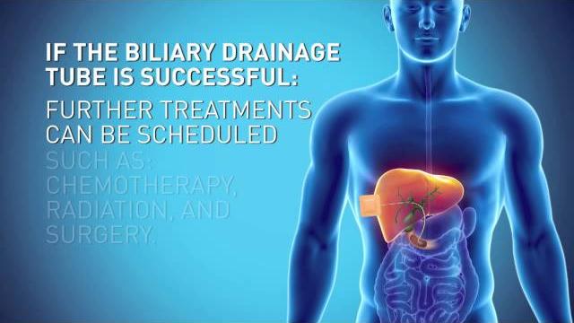 Biliary drain Biliary drain