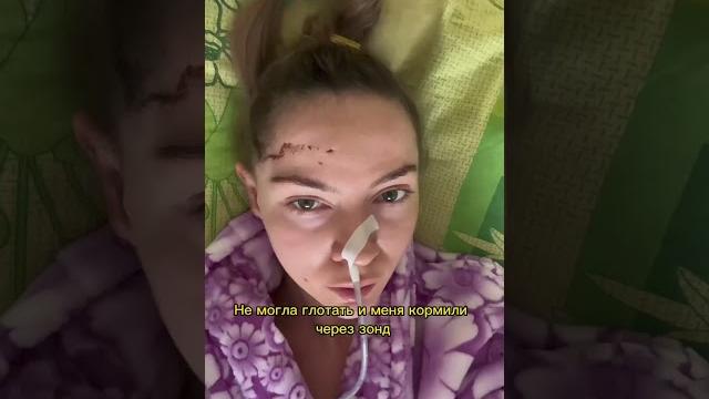 Опухоль мозга. как начался мой 2023год️🩹 #опухоль #невринома #опухольмозга #онкология Опухоль мозга. как начался мой 2023год️🩹 #опухоль #невринома #опухольмозга #онкология