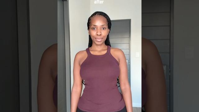 Breast lift + reduction before and after vlog live on my channel! #beforeandafter #breastlift Breast lift + reduction before and after vlog live on my channel! #beforeandafter #breastlift