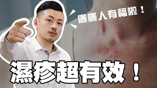 濕疹、汗皰疹好不了!?簡單幾招還你美麗好皮膚!癢癢必學!【77老大】 濕疹、汗皰疹好不了!?簡單幾招還你美麗好皮膚!癢癢必學!【77老大】