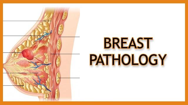 Breast pathology (inflammatory vs. benign vs. malignant) Breast pathology (inflammatory vs. benign vs. malignant)