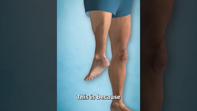 The surgery that turns legs around The surgery that turns legs around